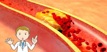 Thumb #1
